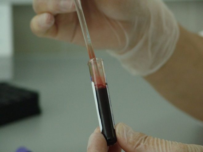Immunologie